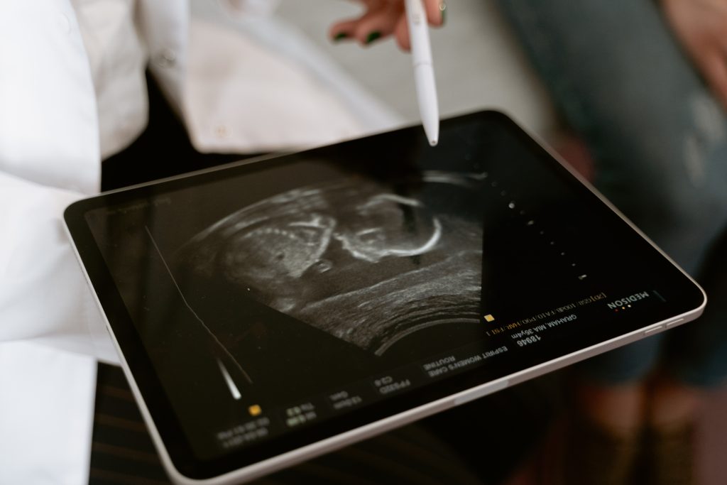Fetal Ultrasound